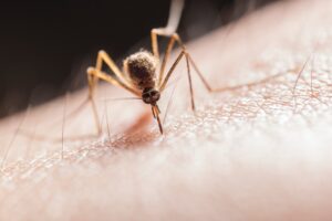 Why do mosquito bites itch?